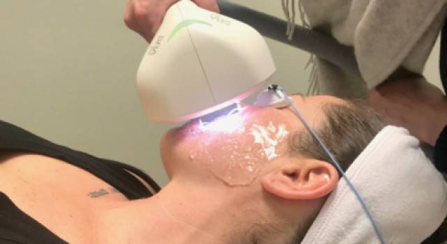Laser Skin Rejuvenation